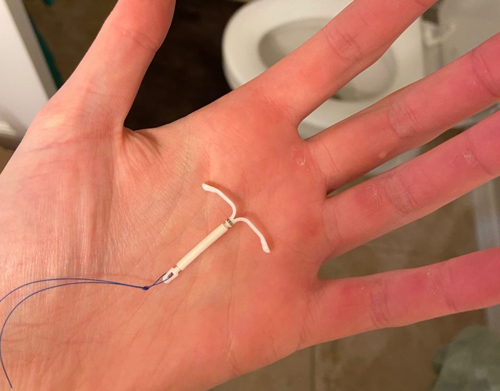 trinity's IUD in the palm of her hand